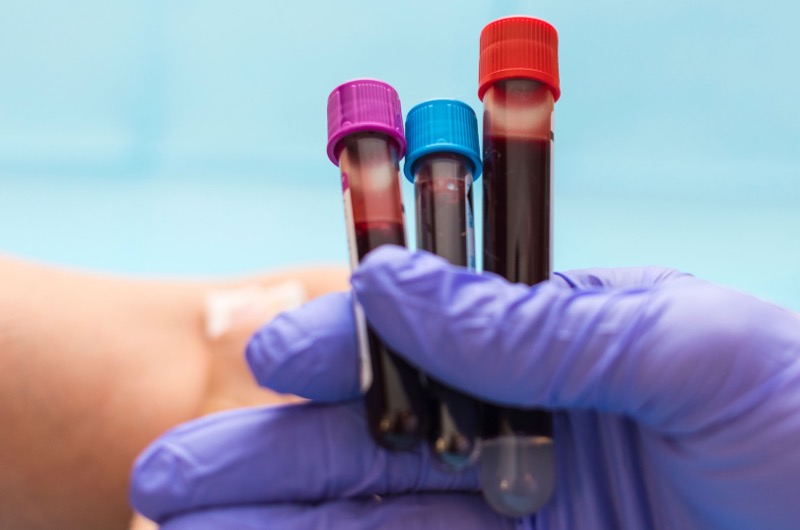 Apotheken dürfen Blut abnehmen