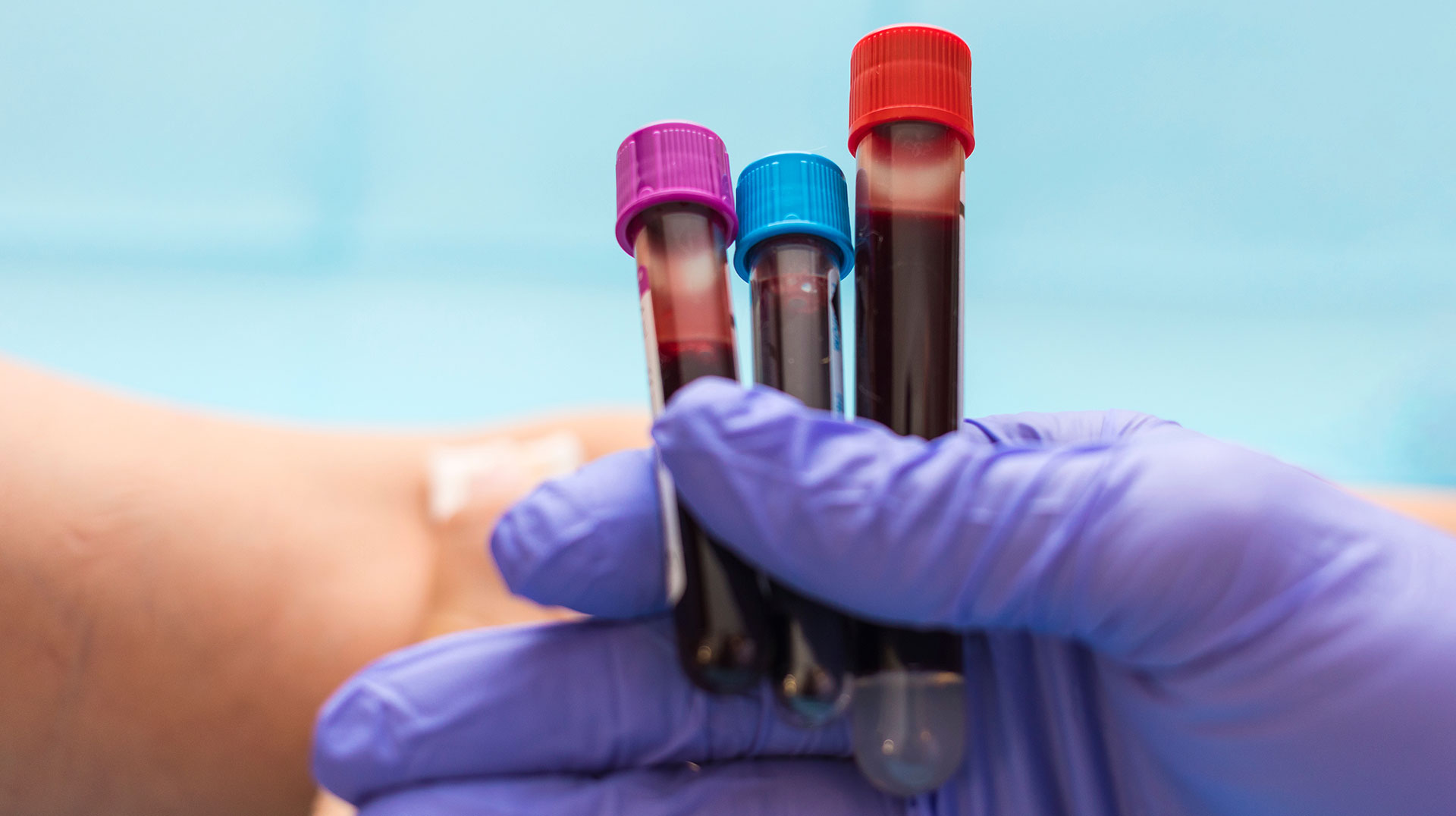 Apotheken dürfen jetzt Blut abnehmen – wann das sinnvoll sein kann
